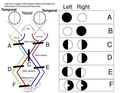 Examining Visual Fields for a Clinical Exam on Meducation | Clinic ...