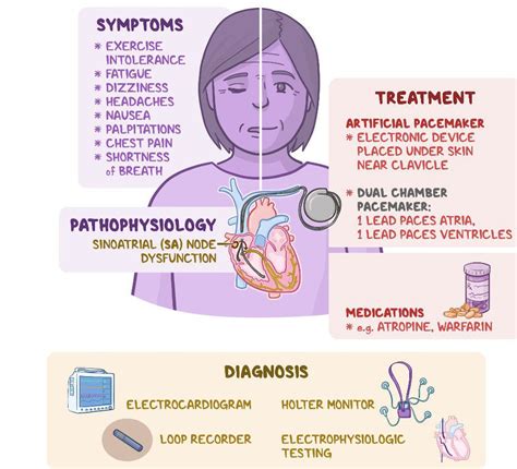 Treatment for Sinus Tachycardia - MEDizzy