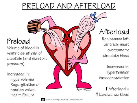 Nursing Mnemonics: Preload vs Afterload - StudyPK