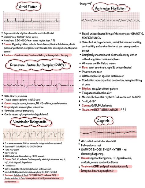 Basic EKG Dysrhythmias & Interpretation Nursing Notes 6 PAGES Digital Download PDF - Etsy Canada ...