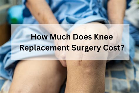 How Much Does Knee Replacement Surgery Cost? | by David W | Medium