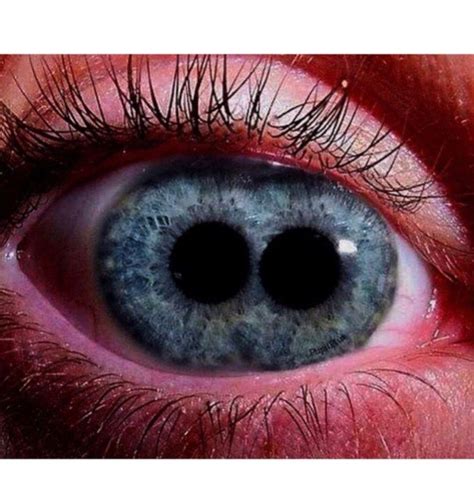 Double pupil mutation | Rare eye colors, Rare eyes, Creepy eyes