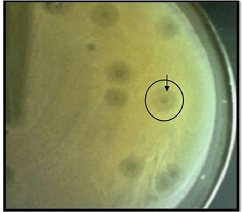 Plaque morphology. Plaques (clear surrounded by a large halo, 3 mm... | Download Scientific Diagram