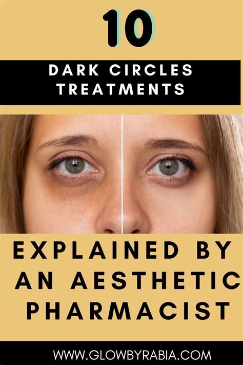 Periorbital dark circles – Artofit