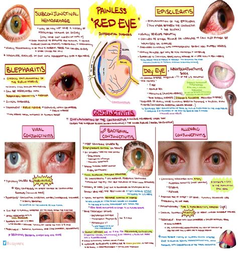 Red Eye Symptoms And Treatment