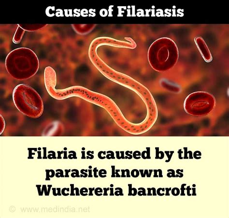 Causes of Filariasis