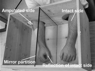 Ashland Human Biology: Phantom Limb Syndrome