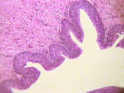 Epithelium Histology - Transitional epithelium - histology slide