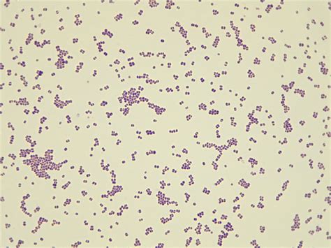 Micrograph Coccus Gram stain 1000x p000031 | OER Commons