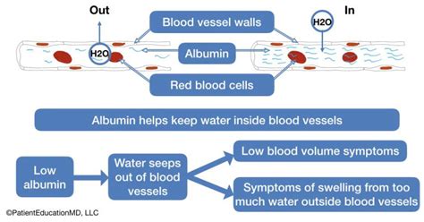 Low albumin symptoms - PatientEducationMD