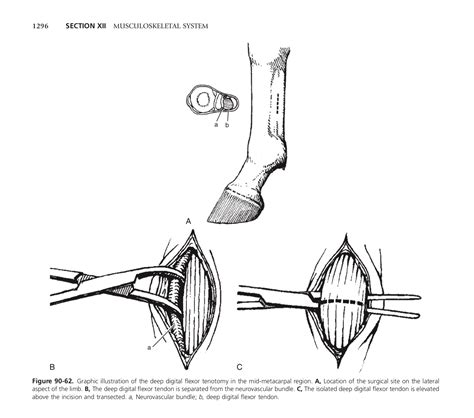 Deep Digital Flexor Tenotomy