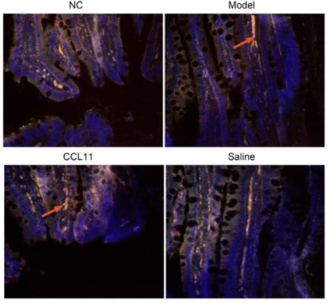 Immunofluorescence distribution of macrophages in intestinal tissue ...