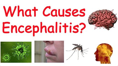 Encephalitis: What Is, Causes, Symptoms, Treatment, and Protection