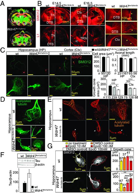 Microtubule-stabilizing role of WDR47 at the growth cone. (A) MRI in... | Download Scientific ...