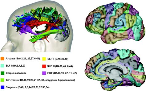 Disorders of visual perception | Journal of Neurology, Neurosurgery ...