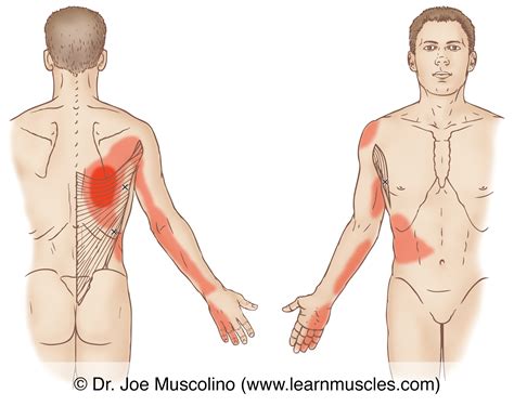 Latissimus Dorsi (Lat) - Trigger Points - Learn Muscles