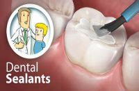 20 Natural Home Remedies for Sensitive Teeth Pain