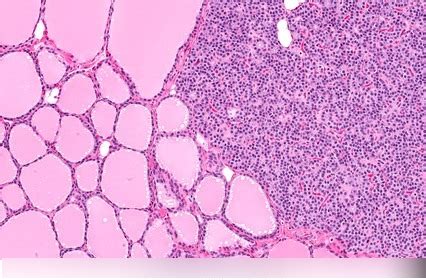 Thyroid and Parathyroid Histology Diagram | Quizlet