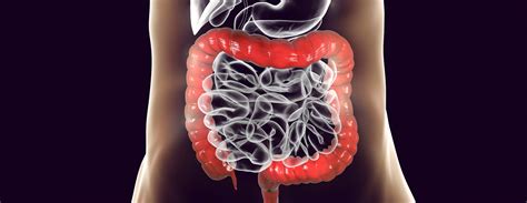 Virtual Colonoscopy | Conditions & Treatments | UCSF Health