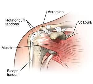 Shoulder Tendonitis | Loma Linda University Health