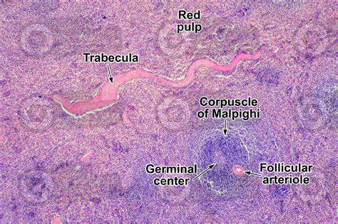 Man. Spleen. Transverse section. 64X - Man - Mammals - Lymphatic system ...