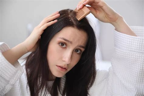 Dandruff During Pregnancy - Causes, Treatment Options, And Home Remedies - Being The Parent