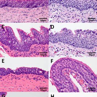 Comparison of the histology and distributions of laryngeal epithelium ...