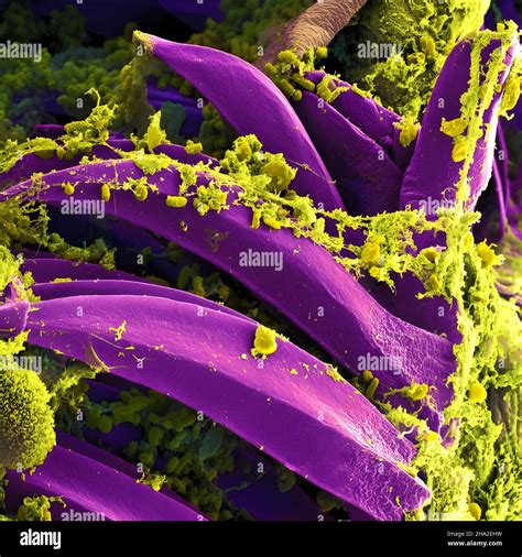 Yersinia pestis culture hi-res stock photography and images - Alamy