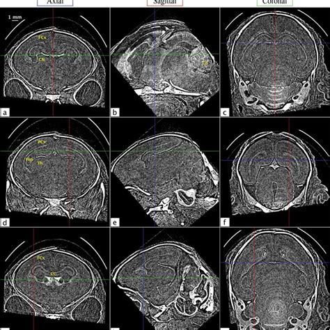 Propagation-based X-ray phase contrast imaging (adapted from Kitchen et... | Download Scientific ...