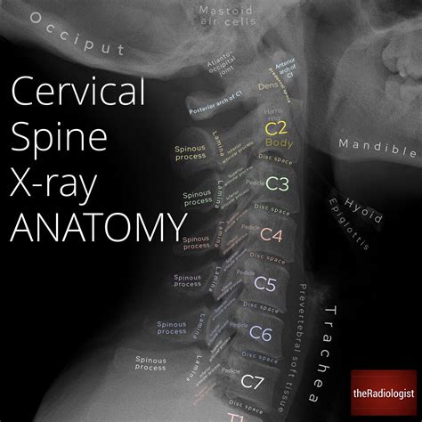 Cervical Spine X Ray Anatomy By Dr Naveen Sharma Grepmed | The Best ...