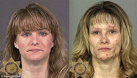 From drugs to mugs: shocking before and after photos show drug addiction takes its toll | Daily ...