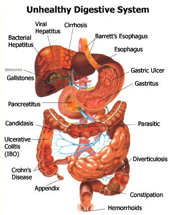 Human Digestive System Illustrations | MedicalNDX