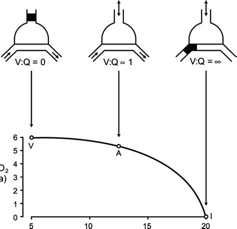 4. The effects of V:Q mismatch on gas exchange (adapted from [20]). The ...