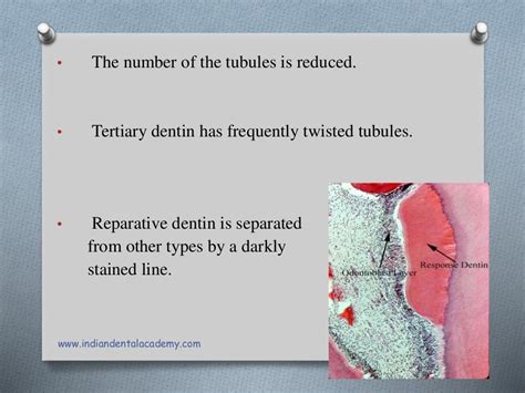 Dentinal tubules and its content final/cosmetic dentistry courses