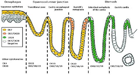 Schematic illustration of cytokeratin (CK) 7 and 20 expression in the... | Download Scientific ...