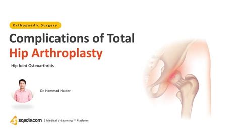 Hip Joint Osteoarthritis - Complications of Total Hip Arthroplasty