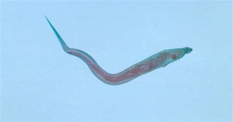 Pinworm Infection: Symptoms, Diagnosis, and Prevention