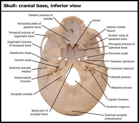 Skull: cranial base, inferior view