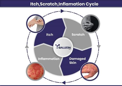 Graphic for presentations to represent "Itch - Scratch - Inframmation ...