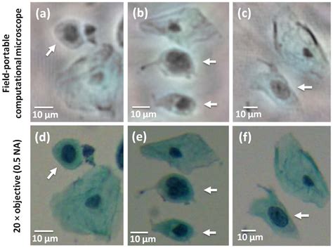 Lensfree computational images of abnormal cells in a Pap smear sample.... | Download Scientific ...