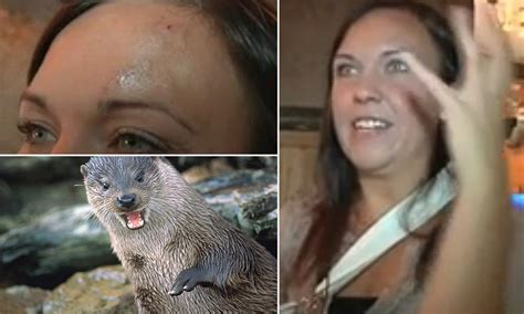 Woman recovering after terrifying otter attack that left her with a broken hand and 8 stitches ...