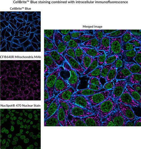 Tech Tip: Combining Lipophilic Membrane Dyes with Immunofluorescence - Biotium