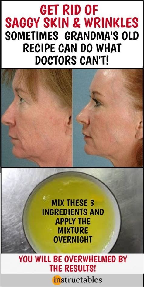 Grandma's Home Remedy to Get Rid of Saggy Skin and Wrinkles in 2020 | Face wrinkles, Saggy skin ...