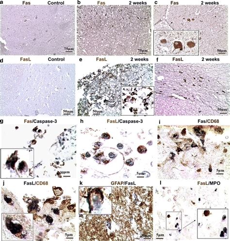 Fas/FasL-mediated apoptosis and inflammation in human SCI. We found few ...