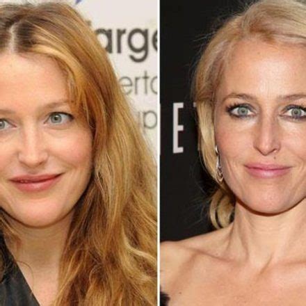 Gillian Anderson Plastic Surgery Rumors and Facts