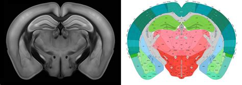 A virtual section of the 3D mo [IMAGE] | EurekAlert! Science News Releases