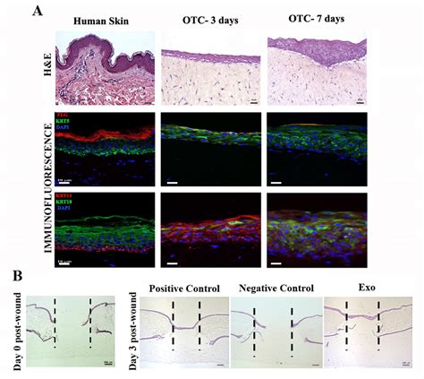 Exosomes support wound healing on a human skin organotypic model. (A ...