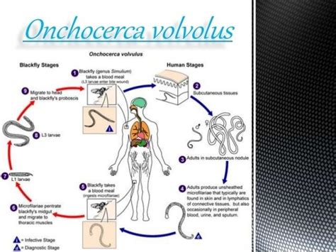 Onchocerca volvulus - Alchetron, The Free Social Encyclopedia