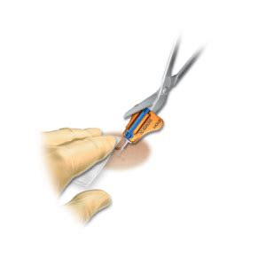 Placement & Removal Procedures - SecurAcath