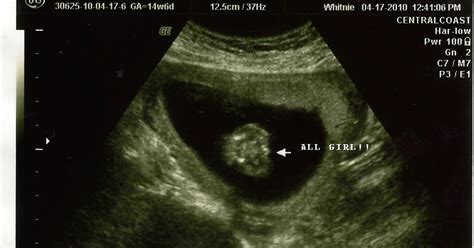 Baby Bonzo: Gender Ultrasound!!